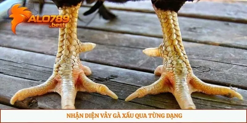 Nhận diện vảy gà xấu qua từng dạng